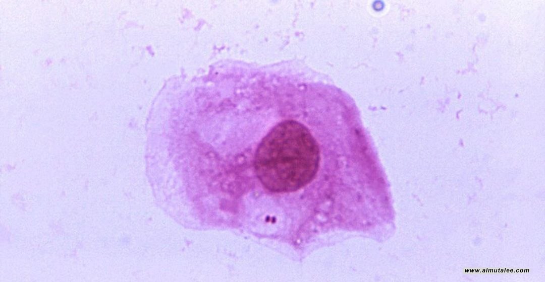 post-image