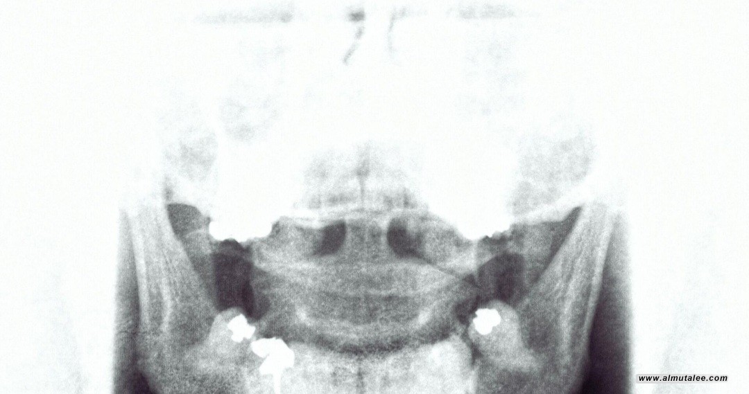 post-image